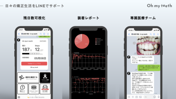 ユーザーインタビュー